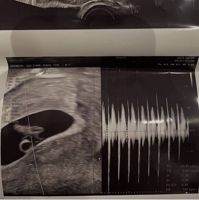 ▲ 출처|서민재 인스타그램