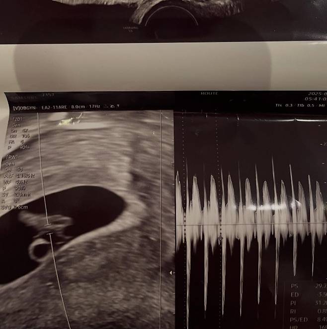 사진=서민재 인스타그램