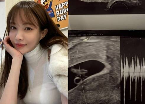 서은우(개명 전 서민재)가 지난 2일 인스타그램에 초음파 사진을 올리며 임신 소식을 전했다. 사진 서은우 인스타그램 캡처