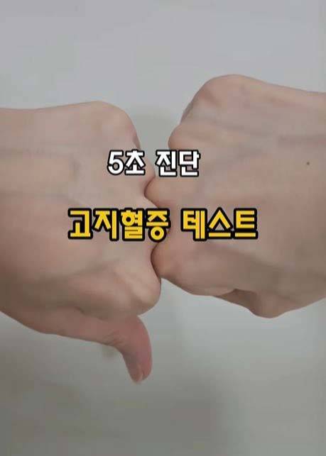 손등뼈 사이 굴곡진 부위에 위치한 '팔사혈'을 지압했을 때 통증이 나타나면 혈액순환에 문제가 있을 가능성은 있다. 하지만 통증이 반드시 고지혈증을 의미하는 것은 아니다./사진=인스타그램 갈무리