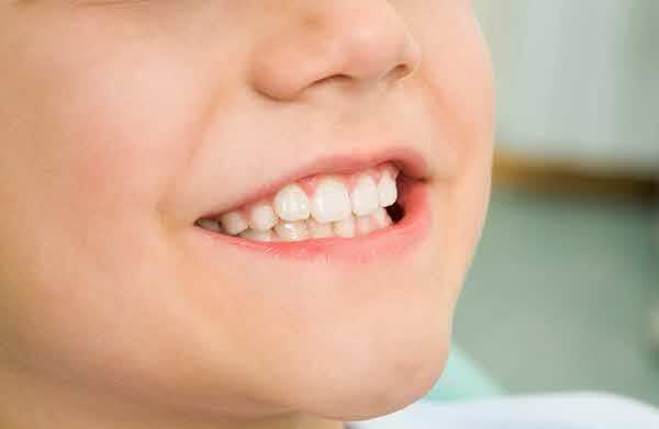 무른 음식만 즐기는 서구화된 식습관은 턱이 들어가 보이는 이른바 '무턱'을 만들 수 있다.​/사진=클립아트코리아