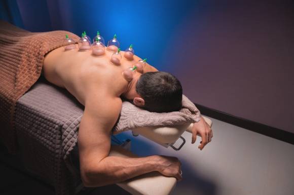 부항 치료 이미지. 아이클릭아트