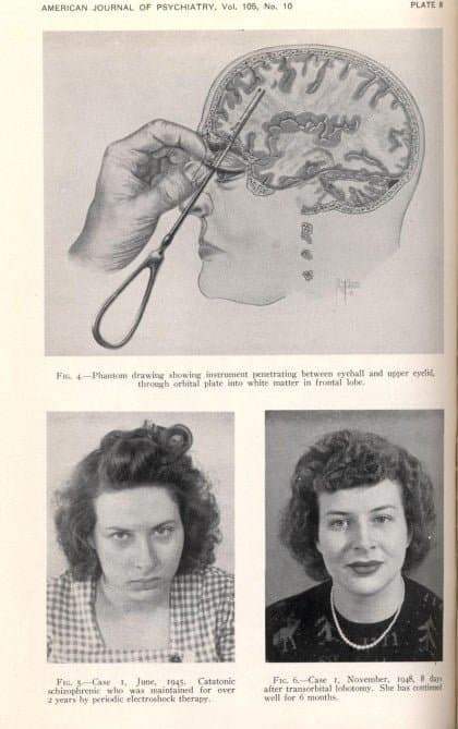 7beb8670abd828a3699fe8b115ef0468a6c0a56b