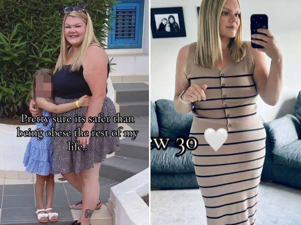 다이어트 주사로 9개월 만에 31kg을 감량했지만, 목주름이 생기고 피부가 처져 노안이 됐다는 커스티의 다이어트 전(왼)과 후(오)의 모습/사진=틱톡 채널 ‘미세스 마마에이’ 캡처