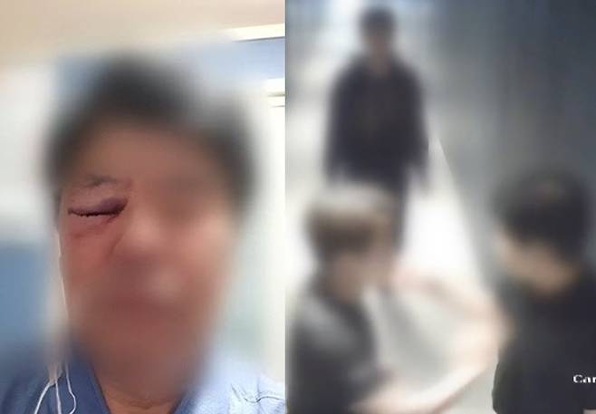 20대 남성에 폭행당한 60대 모텔 주인 A씨(왼쪽)와 당시 이들이 A씨에게 시비를 거는 모습. /사진=JTBC 사건반장 갈무리