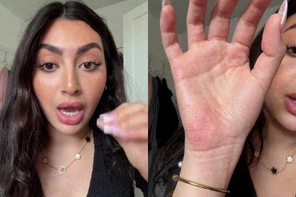 ‘범핑 갱’(Bumping gang), 이른바 ‘어깨빵’ 피해를 호소하는 영국의 틱톡 인플루언서 아일라 멜렉.