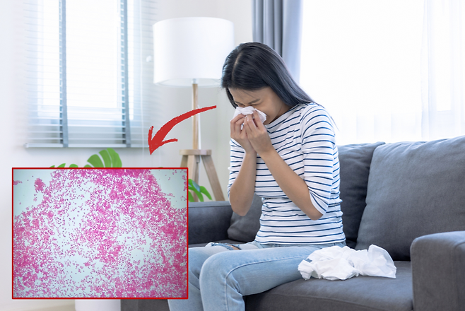 수막구균. [게티이미지뱅크]