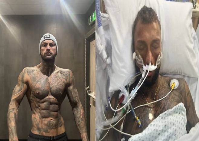 [서울=뉴시스] 15일(현지시각) 영국 데일리메일 등 외신은 근육을 늘리고자 2년 넘게 스테로이드를 복용해 온 30대 남성이 부작용으로 혼수상태에 빠진 사연을 보도했다. (사진=SWNS 캡처) 2025.05.19 *재판매 및 DB 금지