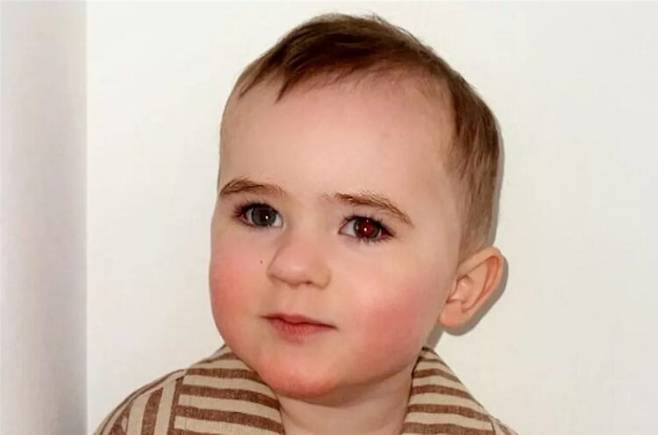 쿠퍼는 망막모세포종(retinoblastoma) 진단을 받았다. 이 병은 6세 이하 어린이에게 주로 발생한다. [사진=SNS]