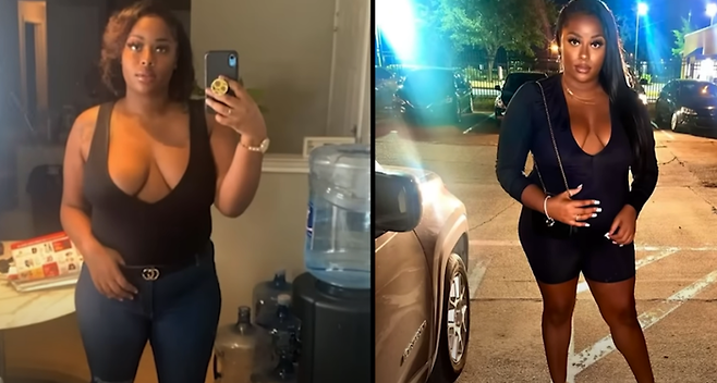 해당 인플루언서의 수술 전 모습. [사진 = 더선]