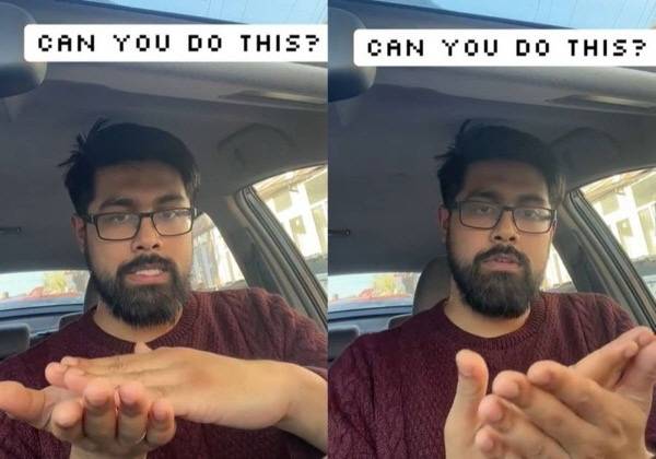 소뇌 이상으로 인한 길항운동반복불능증을 의심할 수 있는 30초 손동작 테스트가 화제다./사진=메디펙셔스 틱톡 캡처​