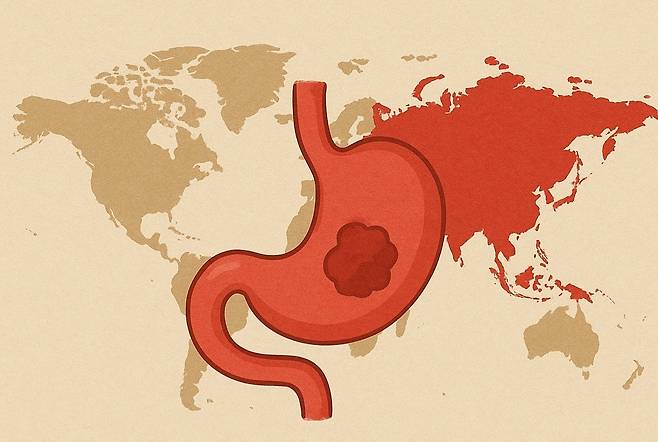 한중일에 유독 많은 위암 [자료 사진]