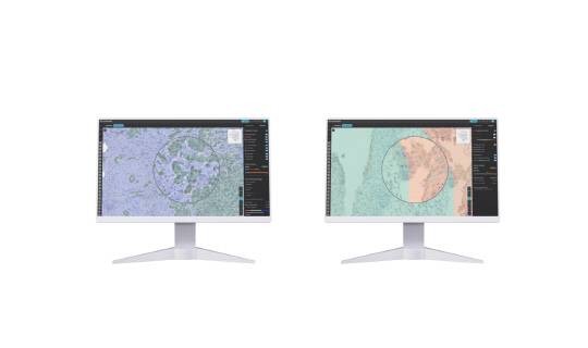 루닛의 AI 바이오마커 플랫폼 루닛 스코프 IO(왼쪽)와 루닛 스코프 PD-L1. 루닛 제공.