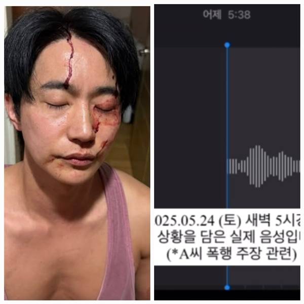 전호준은 25일 자신의 개인 채널을 통해 “2025년 5월 24일(토) 새벽 5시경, 경찰이 현장 확인 후 촬영한 증거 사진입니다”라는 문구와 함께 얼굴에 피를 흘리고 있는 사진을 공개했다. 사진=SNS