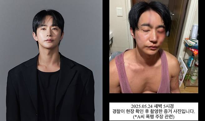 뮤지컬 배우 전호준(왼쪽)이 25일 인스타그램에&nbsp;전날 일어난 연인과의 폭행 사건 관련 자신이 피 흘리고 있는 모습의 사진을 공개했다. 전호준 인스타그램 갈무리