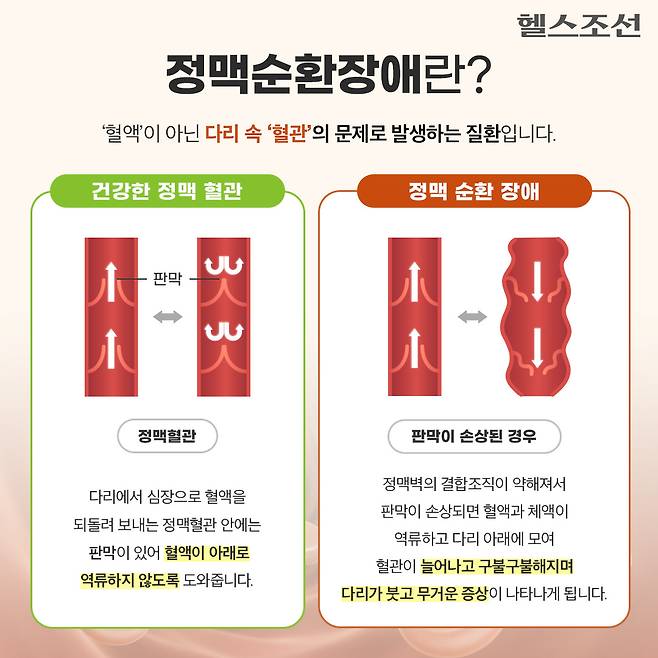 사진=헬스조선DB​​​ ​