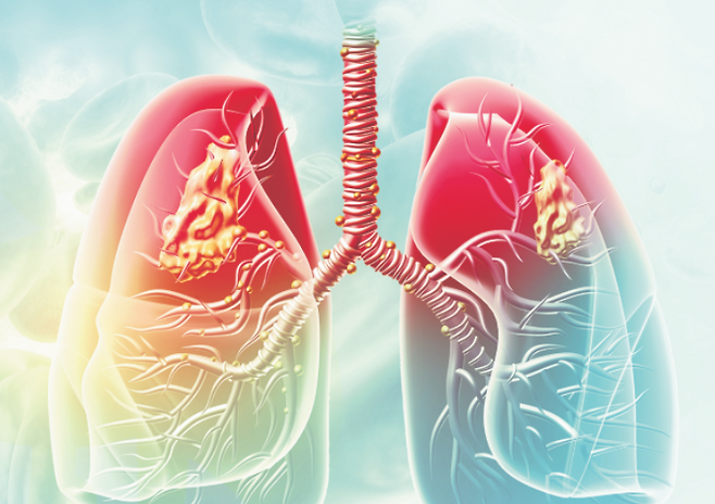 사진 = 게티이미지뱅크