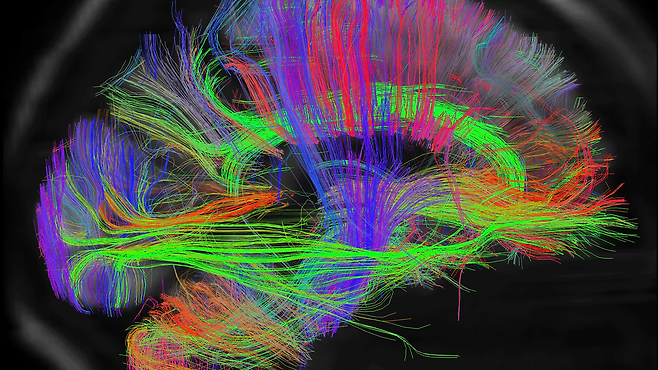 과학자들은 의식을 더 잘 이해하고자 두뇌를 연구하고 있다