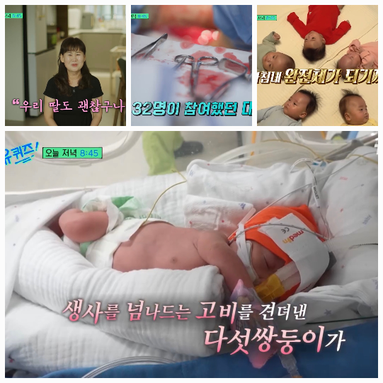 임신 7개월도 채우지 못한 채 시작된 출산. 이른 시기였던 만큼, 의료진 32명이 투입된 대수술이 진행됐다.사진=tvN
