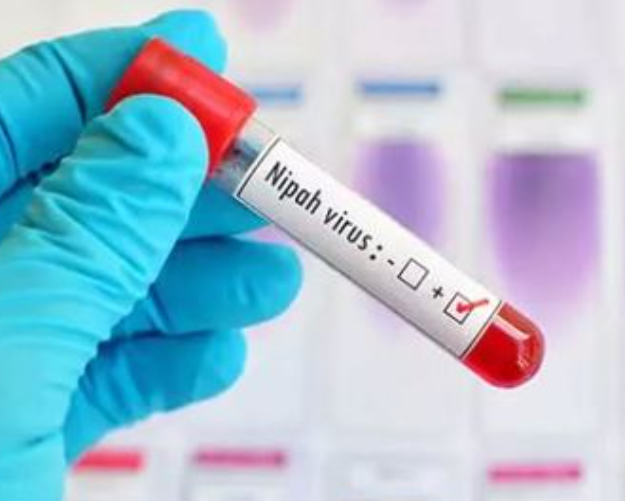 ‘니파바이러스’&nbsp;감염증이 국내에서 제1급 법정 감염병으로 지정된다.&nbsp;게티이미지뱅크