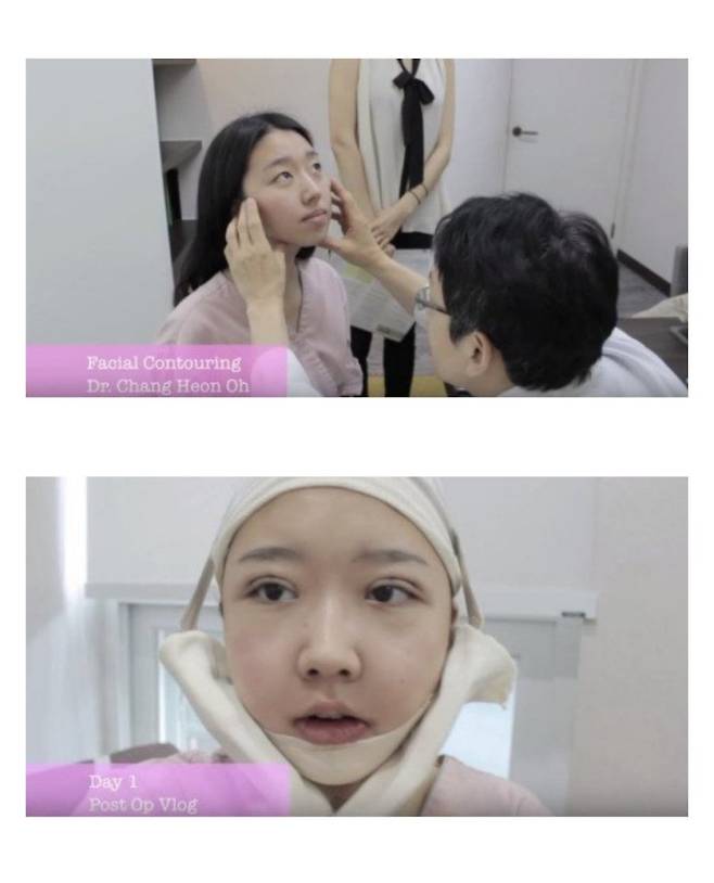 어느 여성 유투버의 성형 전후 모습