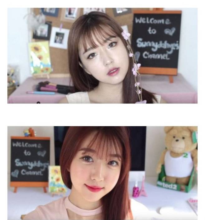 어느 여성 유투버의 성형 전후 모습