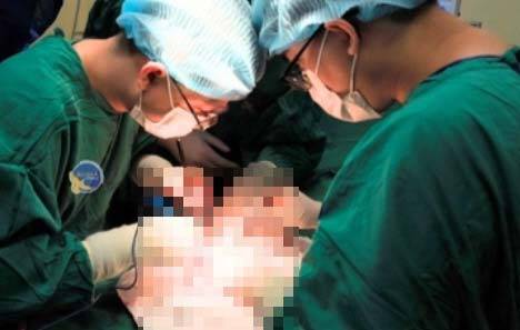 귀두에 생긴 궤양을 2년간 방치했다가 음경암을 진단받은 후 음경 전체를 절단한 A씨를 수술하고 있는 의료진의 모습. /사진=자딘 닷 베트남