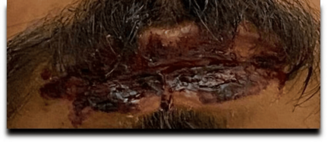 환자의 입술. 사진=Cureus