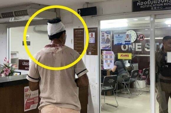 지난달 31일(현지시각) 태국 파타야에서 스리랑카에서 온 50대 남성 관광객이 트랜스젠더 여성의 성별을 확인하겠다며 성기를 만졌다가 폭행을 당하는 일이 발생했다. 사진은 폭행 피해자인 남성이 피를 흘려 머리에 붕대를 감고 있는 모습. /온라인 갈무리