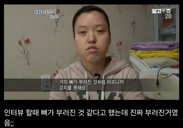 통풍 방치하면 안되는이유