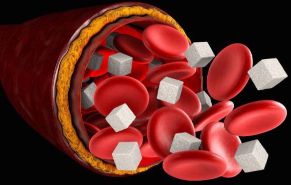 '아보카도'는 특히 혈관 건강에 효과적이다. 사진은 본 기사 내용과 무관.  [사진=humrahi]