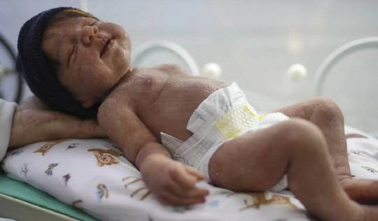 브라질에서 실제 아기와 똑같이 정교하게 제작한 인형인 '리본(Reborn)돌'이 '뜨거운 감자'로 떠올랐다.<AP통신 보도 캡처>