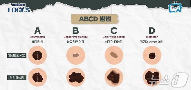 ABCD 자가진단법(서울대병원 제공)