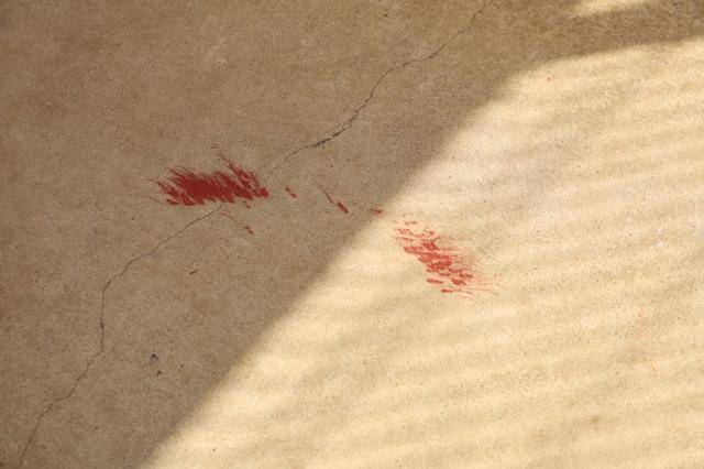 꼬리를 너무 강하게 흔드는 까닭에 보호소 바닥에 두유의 꼬리가 쓸려 출혈이 발생한 적도 있었다. 동물자유연대 제공