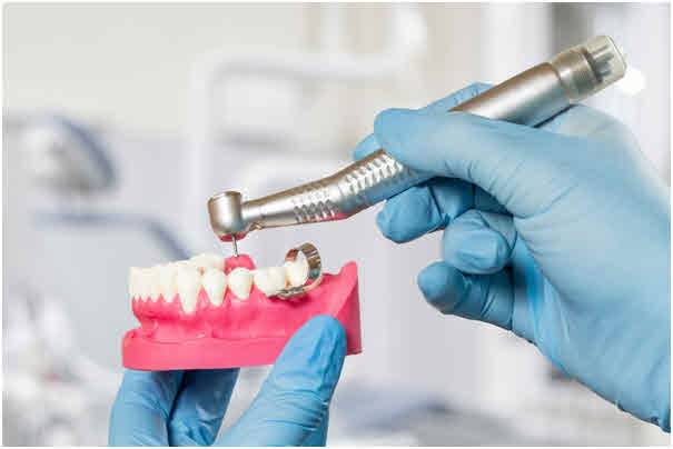 임플란트 이미지. (게티이미지뱅크)