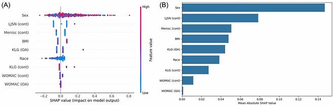 반대쪽 무릎 퇴행성 관절염 예측 모델의 주요 변수 중요도: 성별, 반대쪽 무릎의 외측 관절 간격 감소(LJSN), 반대쪽 무릎의 반월판 절제술 수술력(Menisc), 체질량지수(BMI) 순으로 영향을 미친다. /그림=서울대병원