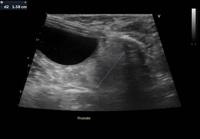 us0013.jpg 강아지 중성화 건강때문에도한다