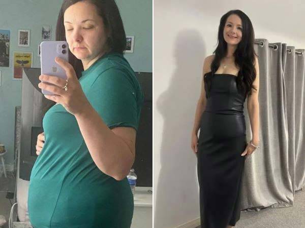 50kg을 감량한 웰시의 다이어트 전(왼)과 후(오)./사진=더 선
