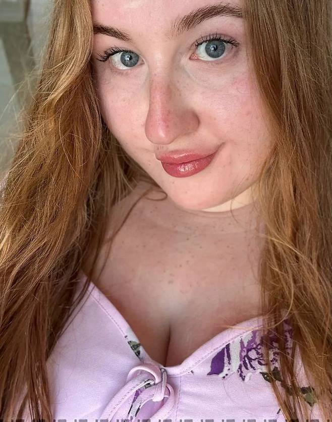 [뉴시스]사진은 희귀 뇌종양에 걸렸던 니암 로즈 멀헤런(사진=스코티시선) *재판매 및 DB 금지