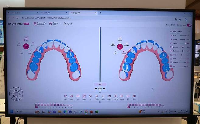 닥터덴트AI는 서로 다른 치료 옵션 시나리오를 동시에 보면서 비교할 수 있다 / 출처=IT동아