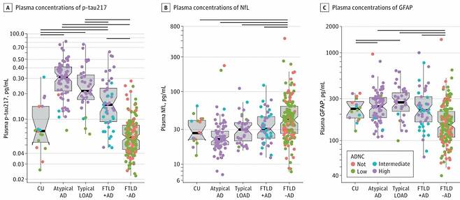 세 가지 바이오마커(p-tau217, NfL, GFAP)를 여러 치매 종류에 적용했을 때 비교 분석한 그래프. /자료=강남세브란스병원