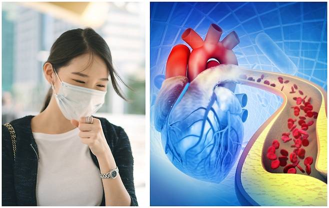 암 생존자는 초미세먼지에 노출되면 심근경색ㆍ뇌졸중 등 심혈관질환 발생 위험이 높지만, 코로나19 기간 동안은 이 연관성이 사라진 것으로 나타났다. 게티이미지뱅크