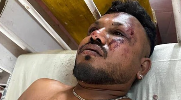 242명을 태운 에어인디아 여객기가 12일(현지시간) 인도 서부 구자라트주 아메다바드 공항에서 이륙한 직후 추락했다. 사진은 승객 242명 중 유일한 생존자로 추정되는 인도계 영국인 라메쉬가 병원에서 치료를 받는 모습. 힌두스탄타임스 제공