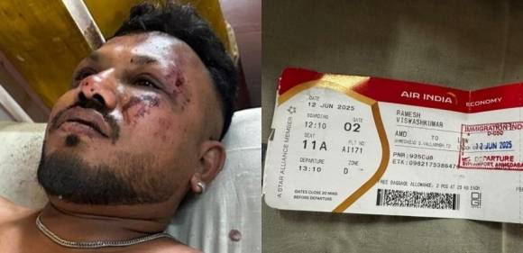 지난 12일 에어인디아 여객기 추락 사고의 유일한 생존자 라메쉬 비슈와스쿠마르 부하르바디의 모습. 힌두스탄타임스 캡처
