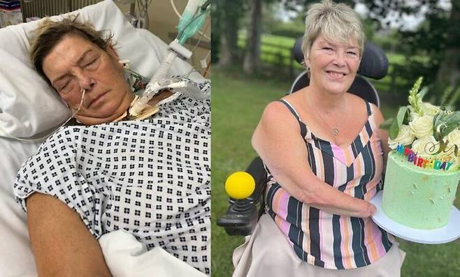 흔한 요로감염으로 인해 손과 다리를 절단하는 고통스러운 일을 겪은 여성의 사연이 소개됐다. [사진=SNS]