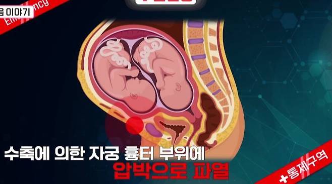 TV CHOSUN 신규 예능 ‘우리 아기가 태어났어요’