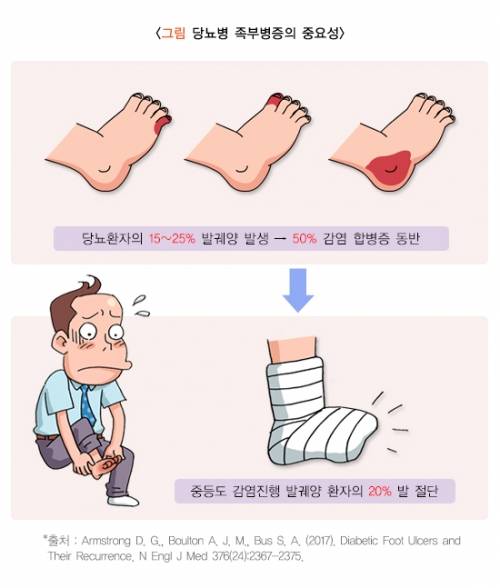 당뇨병성 족부질환의 개요. 자료 : 질병관리청 국가건강정보포털