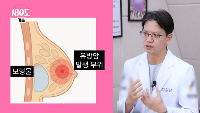 가슴계의 마더테레사라는 강남 성형외과 의사...jpg