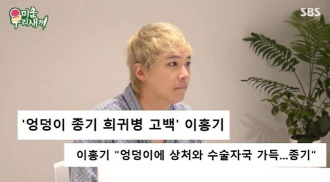 이홍기가 20년 가까이 앓아온 희귀 질환을 고백하며 안타까움을 안겼다. SBS 제공