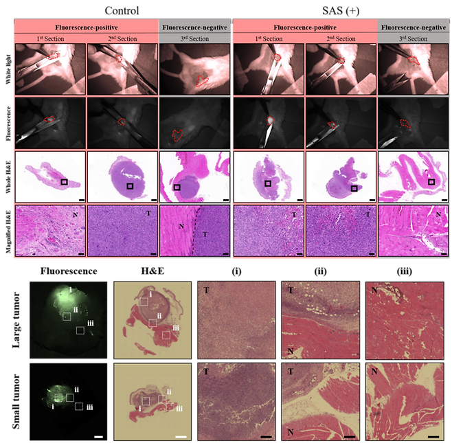 형광 가이드 수술에서의 조직 분석